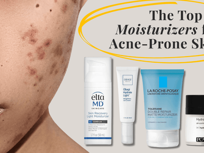 The Top 10 Moisturizers for Acne-Prone Skin