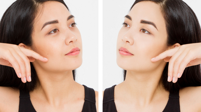 The Ultimate Guide To Banishing Dark Circles