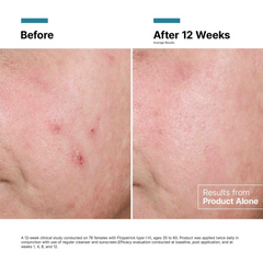 SkinCeuticals Advanced RGN-6