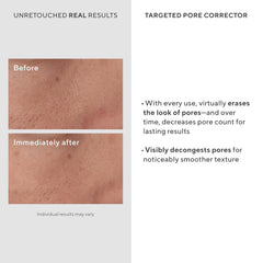 Murad Targeted Pore Corrector