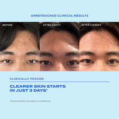 Murad Biome-Balancing Clear & Prevent Acne Treatment Serum