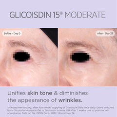 ISDIN Glicoisdin 15 Moderate Exfoliating Glycolic Acid Face Gel