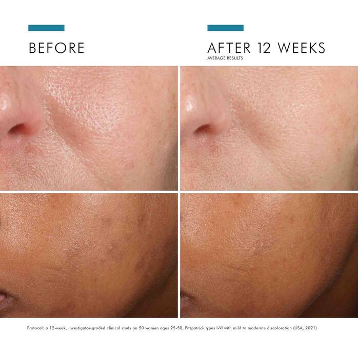SkinCeuticals Phloretin CF SkinCeuticals 1.0 fl. oz. Shop at Exclusive Beauty Club