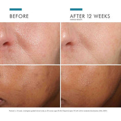 SkinCeuticals Phloretin CF SkinCeuticals 1.0 fl. oz. Shop at Exclusive Beauty Club