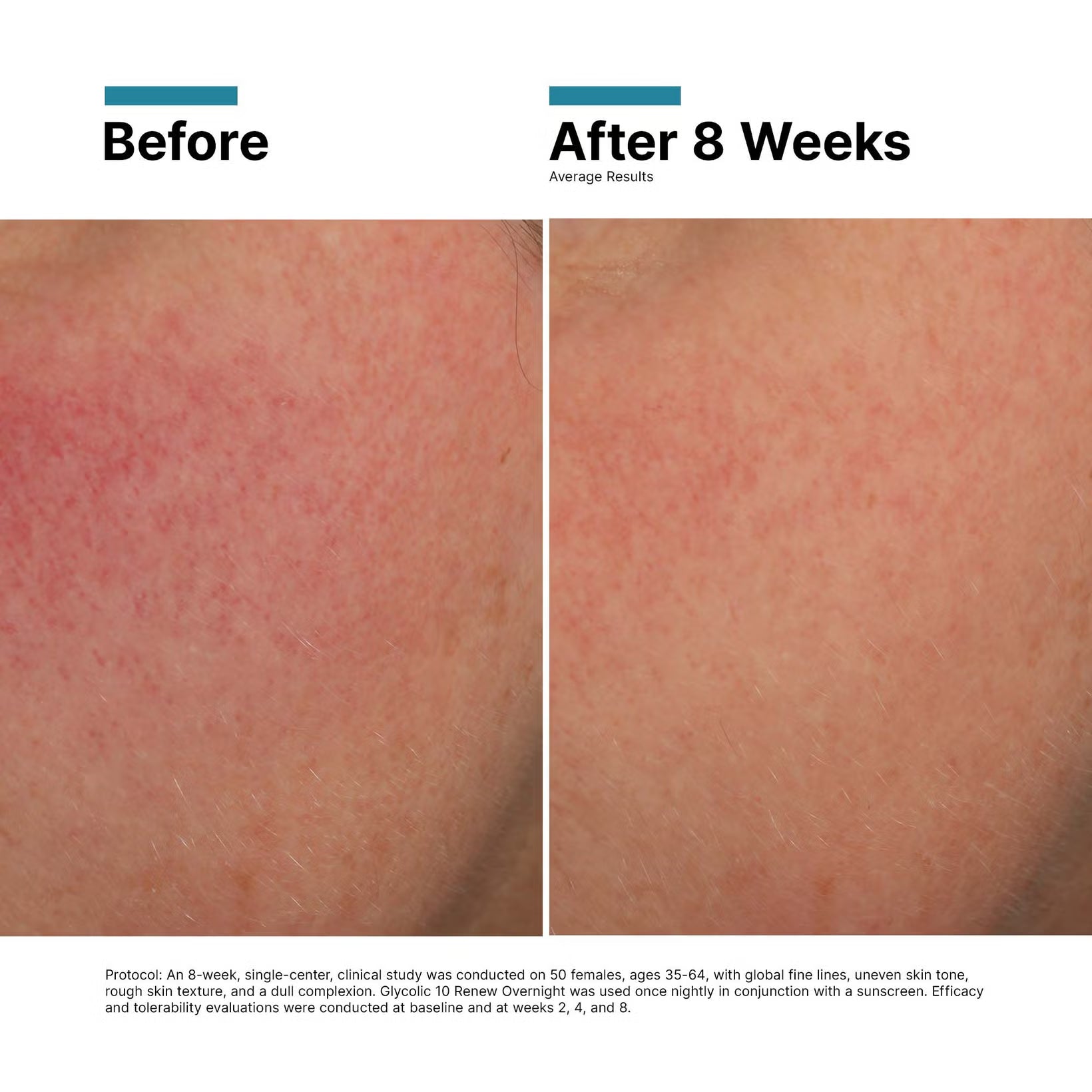 SkinCeuticals Glycolic 10 Renew Overnight SkinCeuticals 1.7 fl. oz. Shop at Exclusive Beauty Club