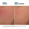 SkinCeuticals Glycolic 10 Renew Overnight SkinCeuticals 1.7 fl. oz. Shop at Exclusive Beauty Club
