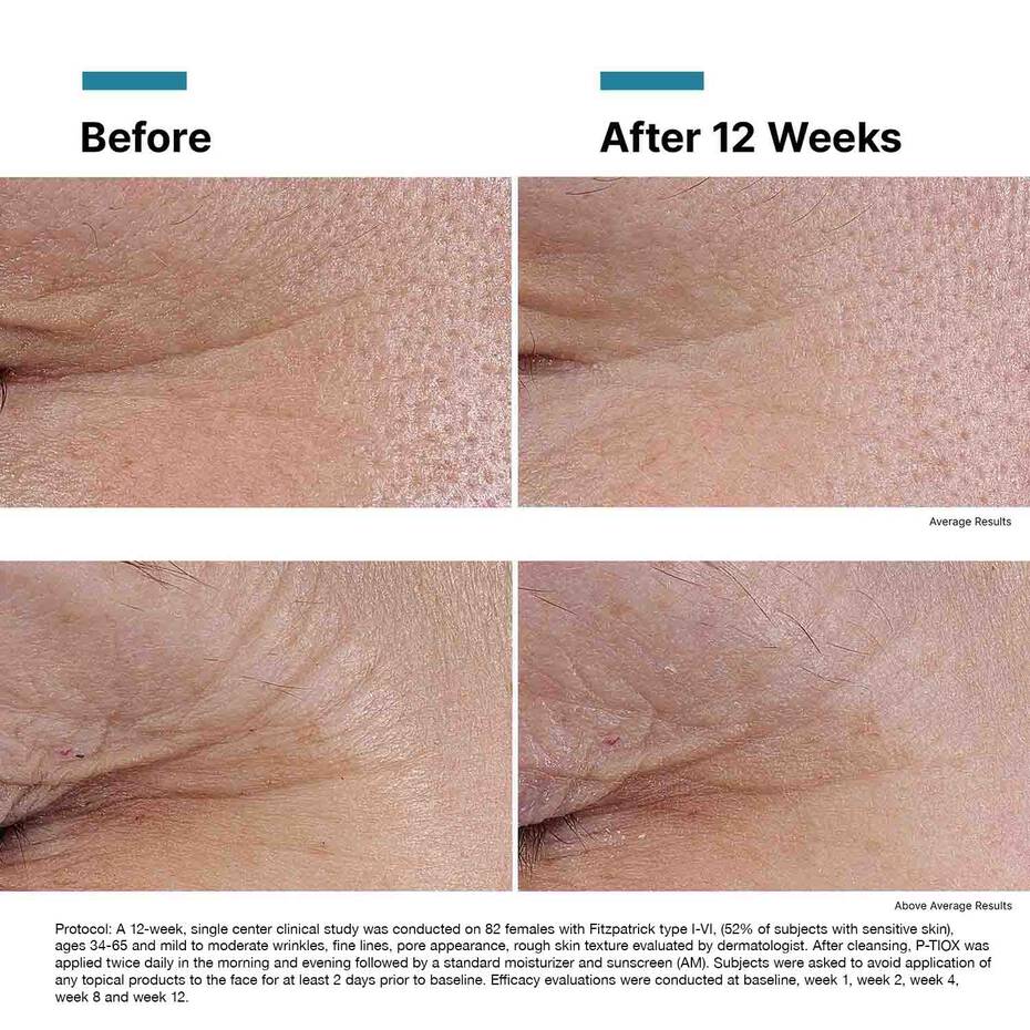 SkinCeuticals p-TIOX Wrinkle Modulating Peptide Serum Shop at Exclusive Beauty Club