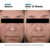 SkinCeuticals Redness Neutralizer SkinCeuticals 1.67 fl. oz. Shop at Exclusive Beauty Club