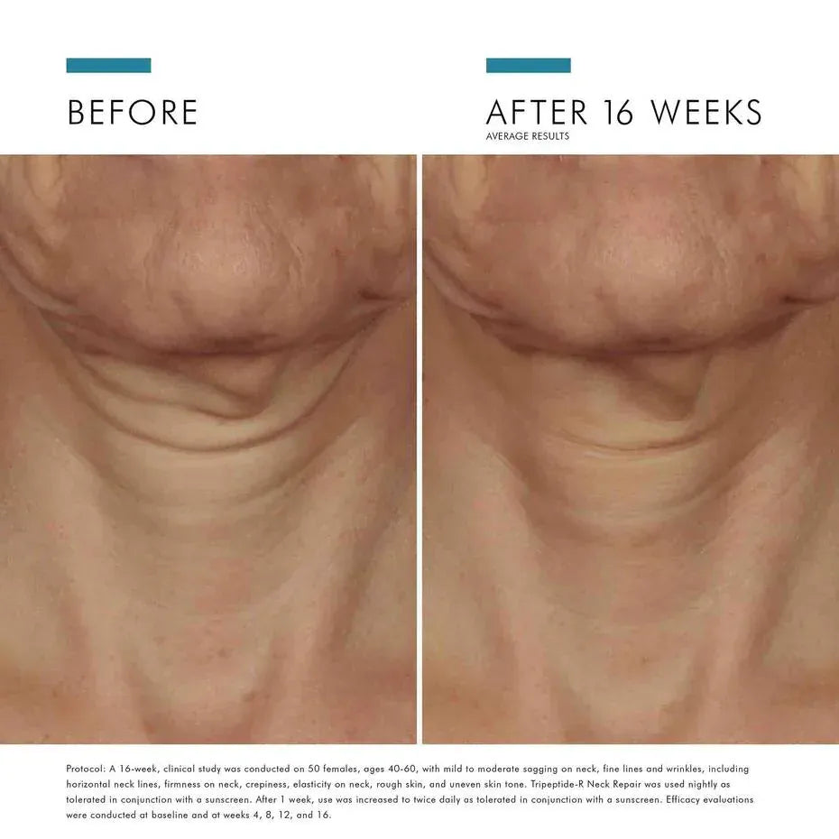 SkinCeuticals Tripeptide-R Neck Repair SkinCeuticals 50ml / 1.7 fl. oz Shop at Exclusive Beauty Club