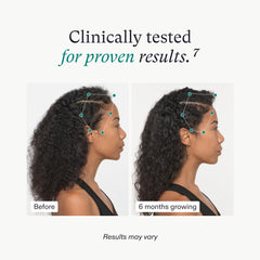 Nutrafol Women's Vegan Hair Growth Nutraceutical