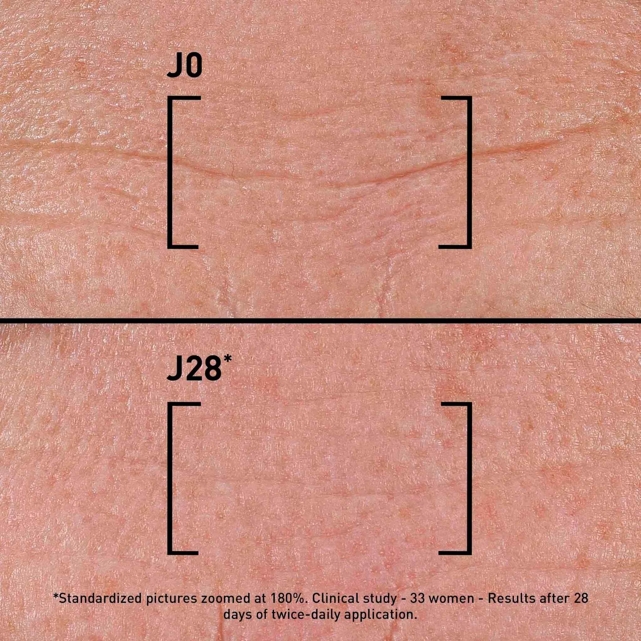 Filorga Time-Filler Intensive 5XP before and after J0 versus J28 skin close-up showing reduced wrinkles after 28 days