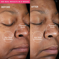 PMD Clean Mini Pink 5