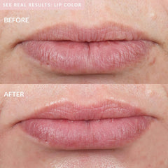 PMD Kiss Lip Plumping System