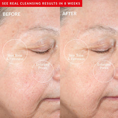 PMD Clean Redvolution Red Light Therapy Device