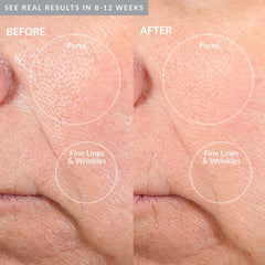 PMD Microderm Pro White 3