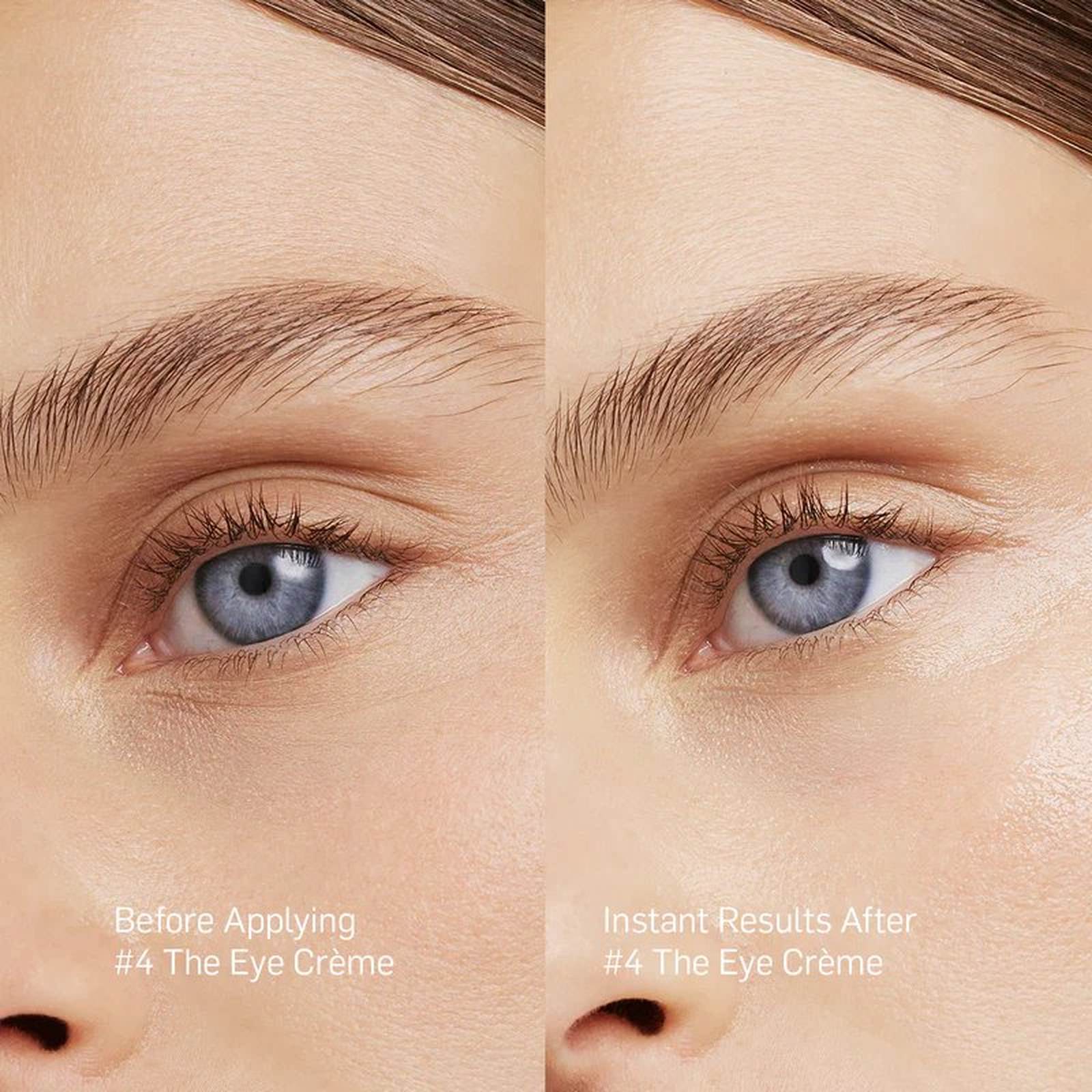 Before and after Rationale Eye Crème showing reduced fine lines dark circles and brighter more refreshed eye area