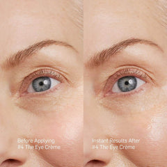 Before and after Rationale Eye Crème on mature skin showing visibly smoother under-eye area and reduced appearance of wrinkles