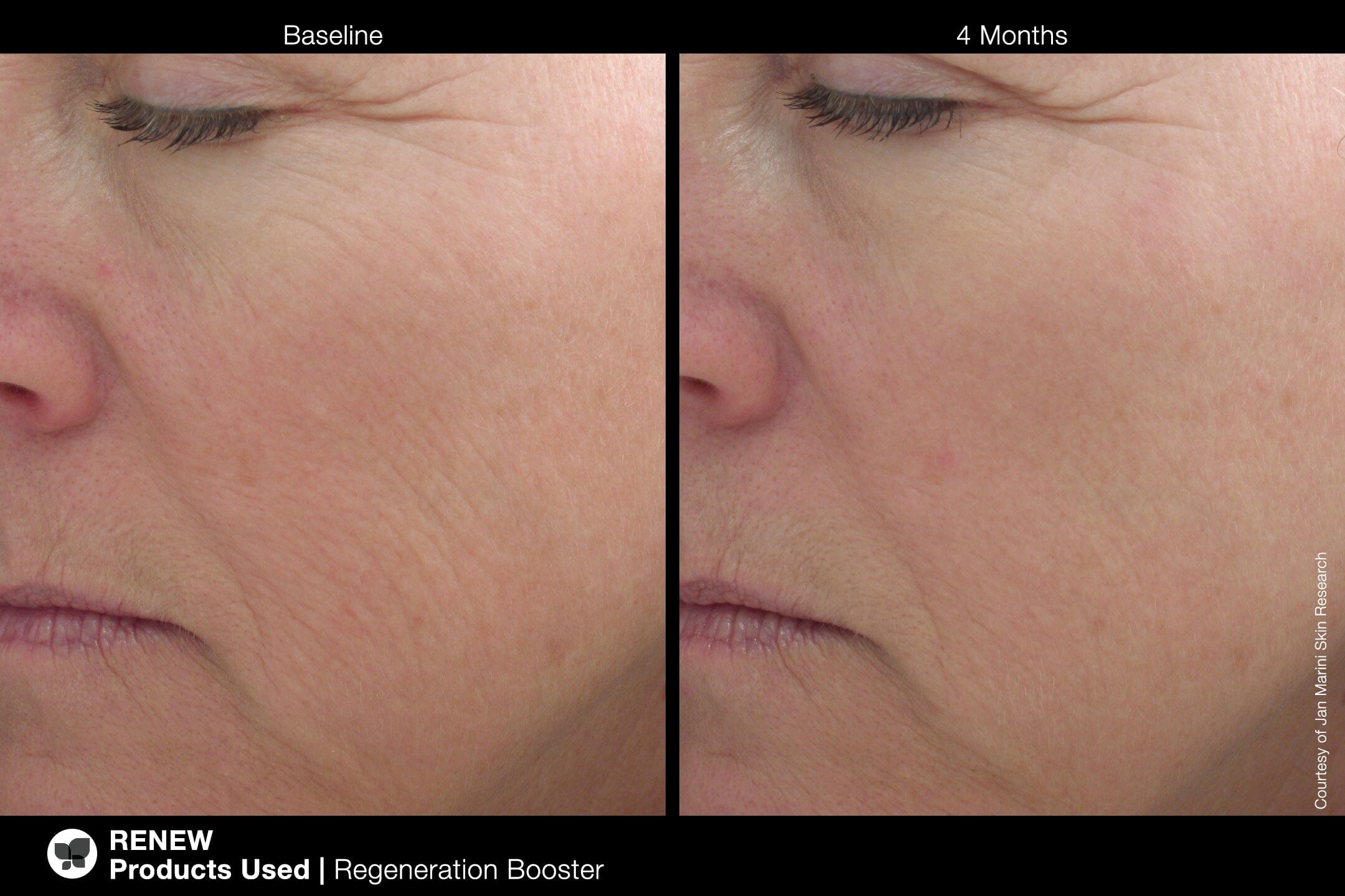 Jan Marini Age Intervention Regeneration Booster Jan Marini Shop at Exclusive Beauty