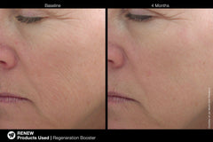 Jan Marini Age Intervention Regeneration Booster Jan Marini Shop at Exclusive Beauty