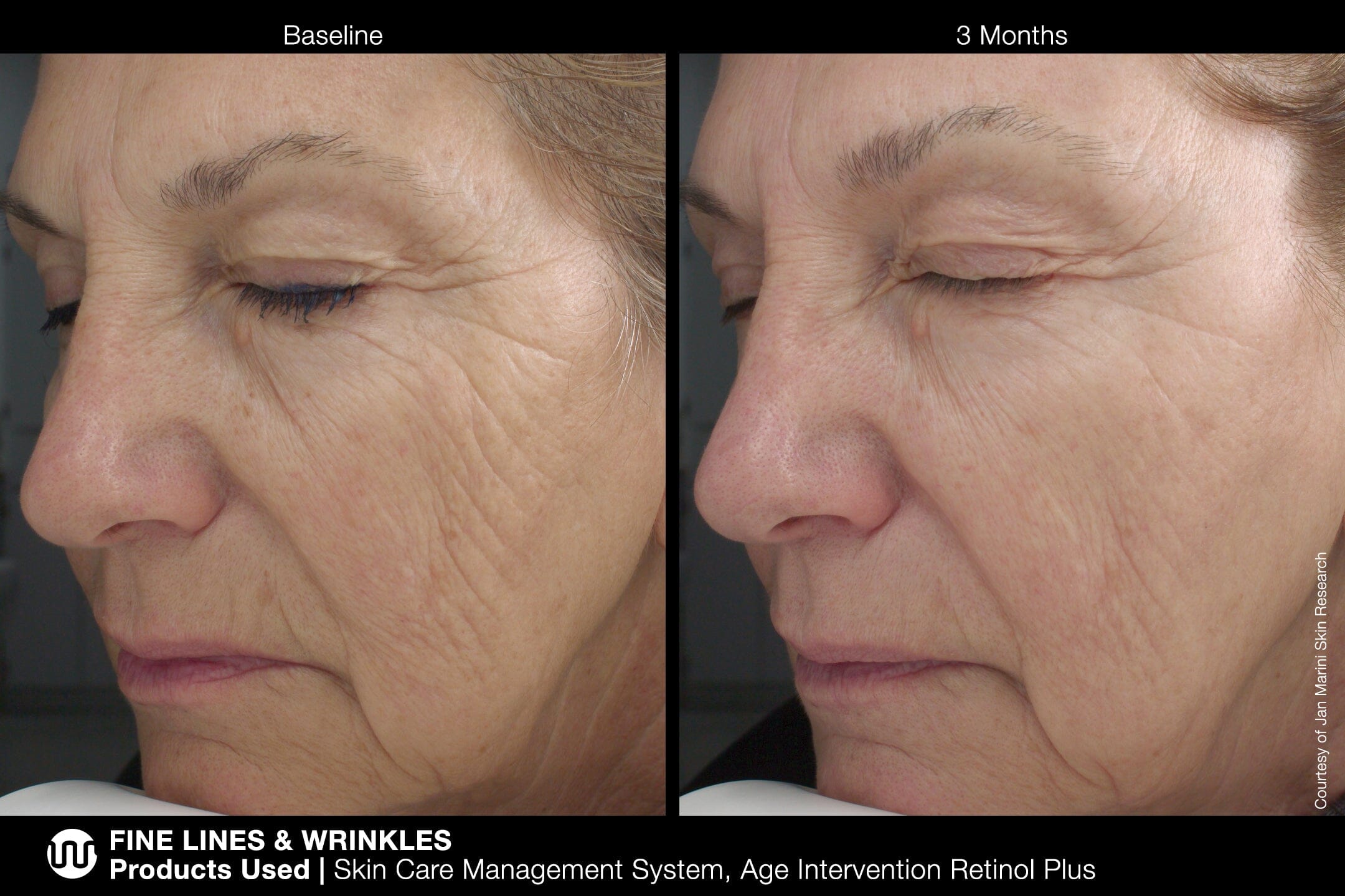 Jan Marini Age Intervention Retinol PLUS MD Jan Marini Shop at Exclusive Beauty