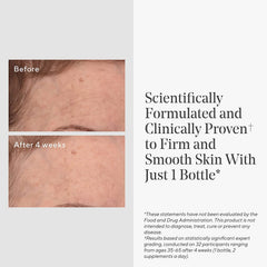 Murad Youth Renewal Supplement Murad Shop at Exclusive Beauty