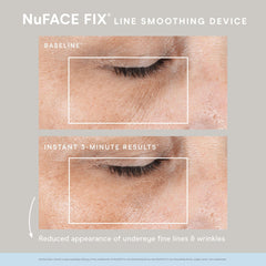 NuFACE FIX KIT NuFACE Shop at Exclusive Beauty