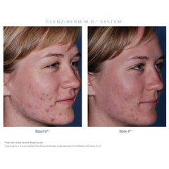 Obagi CLENZIderm M.D. System Obagi Shop at Exclusive Beauty