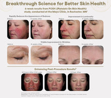 Load image into Gallery viewer, Plated Skin Science INTENSE Serum 6-week study results with before and after images
