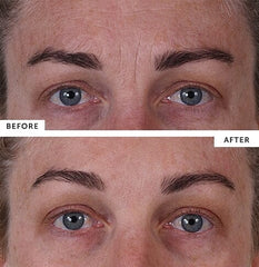 SilcSkin Full Face Set SilcSkin Shop at Exclusive Beauty