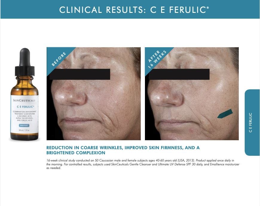 SkinCeuticals CE Ferulic Antioxidant Serum Skin Care SkinCeuticals Shop at Exclusive Beauty