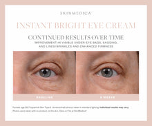 Load image into Gallery viewer, SkinMedica Instant Bright Eye Cream SkinMedica Shop at Exclusive Beauty Club
