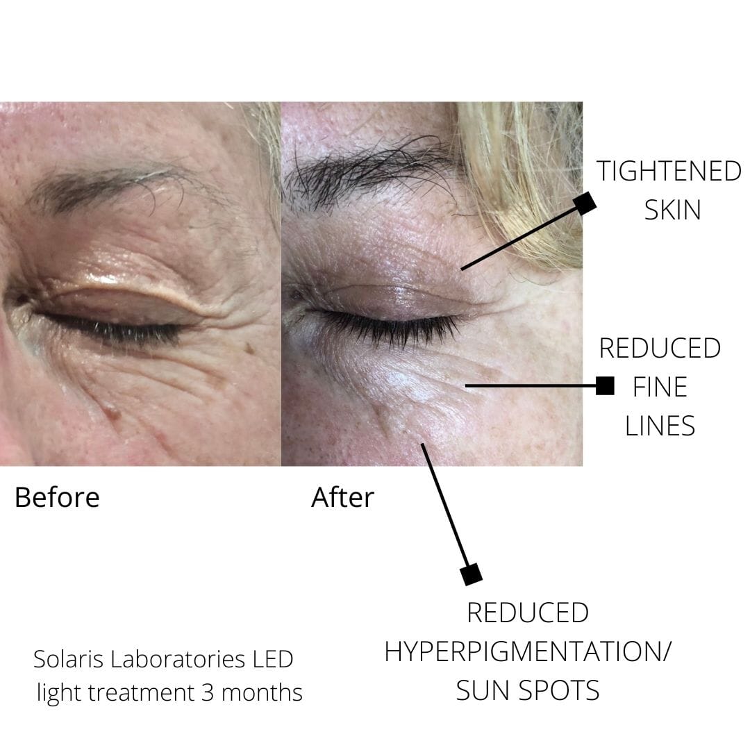 Solaris Laboratories NY How To Glow 4 Color LED Light Therapy Mask Solaris Laboratories NY Shop at Exclusive Beauty