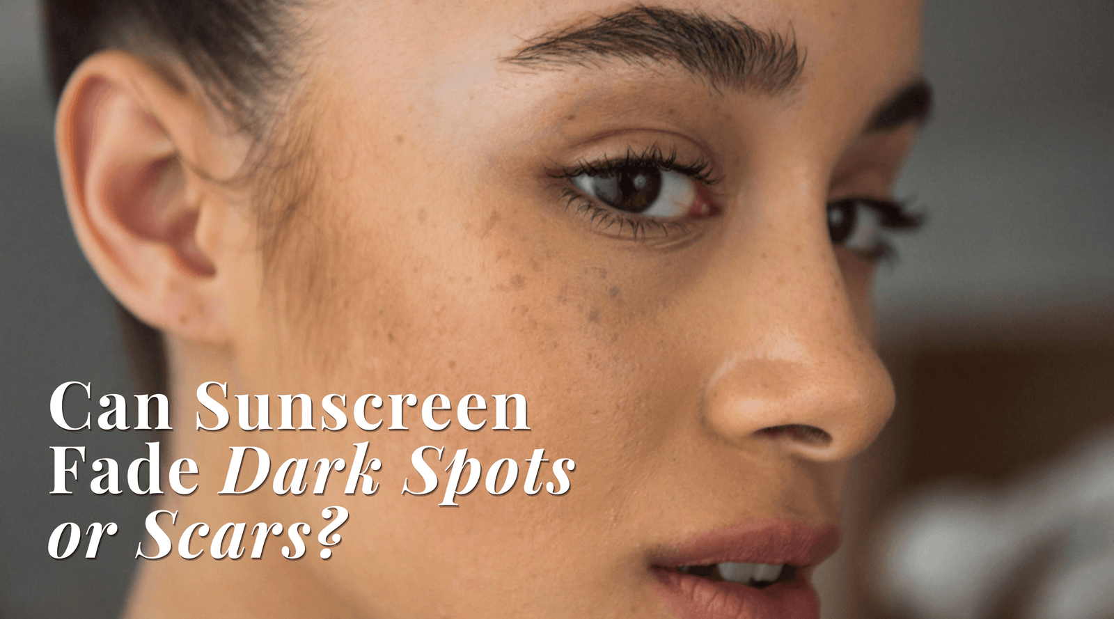 Can Sunscreen Fade Dark Spots or Scars?