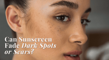 Can Sunscreen Fade Dark Spots or Scars? Read more at Exclusive Beauty Club
