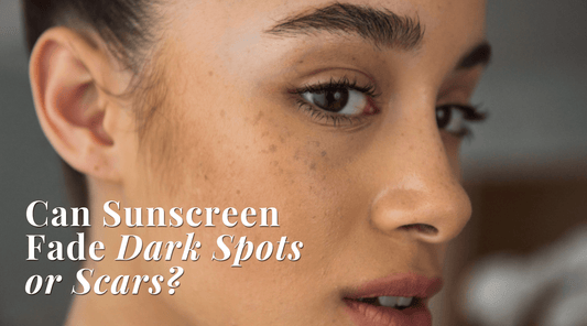 Can Sunscreen Fade Dark Spots or Scars? Read more at Exclusive Beauty Club