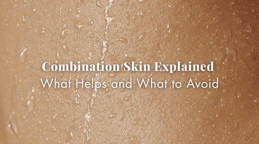 Combination Skin Explained: What Helps and What to Avoid Read at Exclusive Beauty Club Skincare Blog