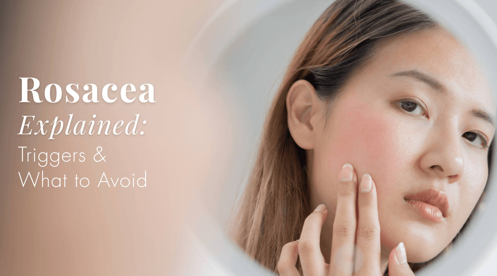 Rosacea Explained: Triggers and What to Avoid