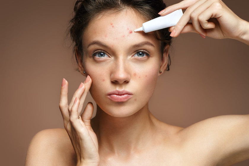 Junio ​​es el mes de concientización sobre el acné ~ 5 formas de combatir el Maskne