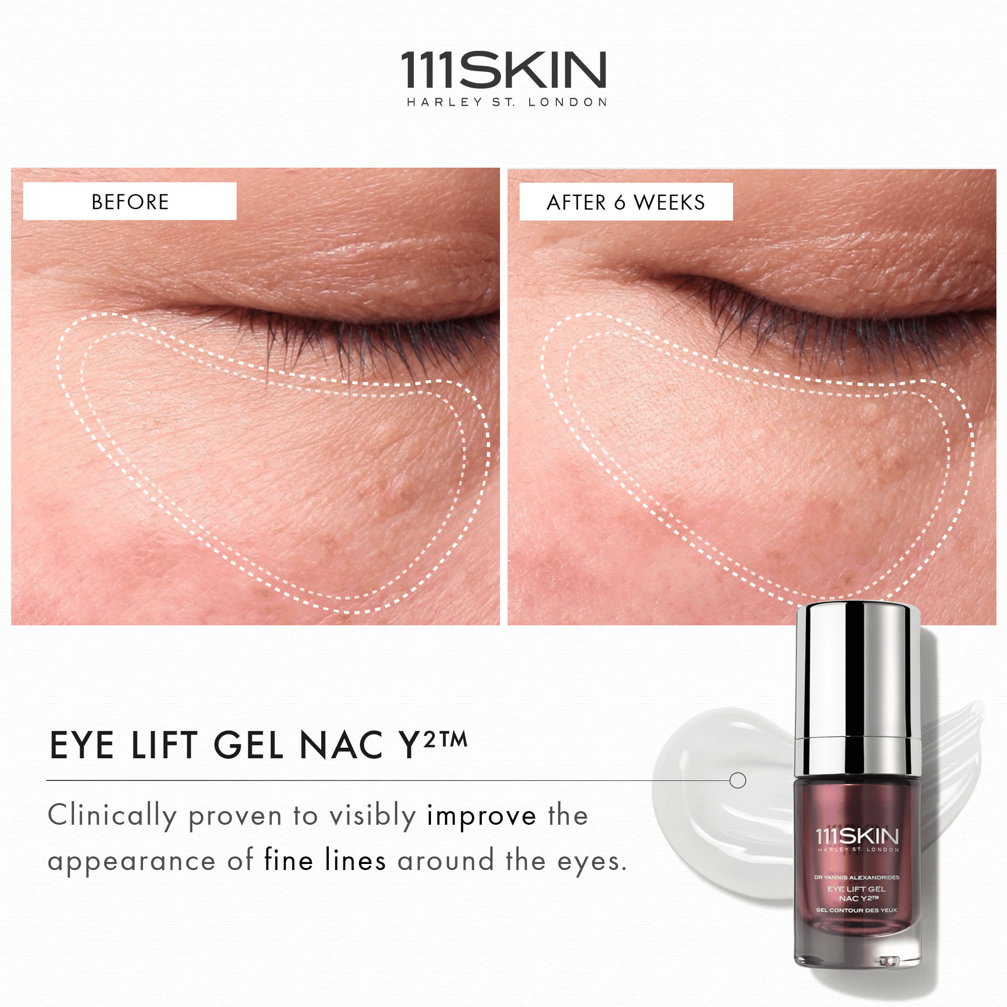 111Skin Eye Lift Gel NAC Y2 available at Exclusive Beauty Club. Dark circles and fine lines.
