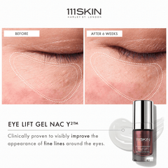 111Skin Eye Lift Gel NAC Y2 available at Exclusive Beauty Club. Dark circles and fine lines.