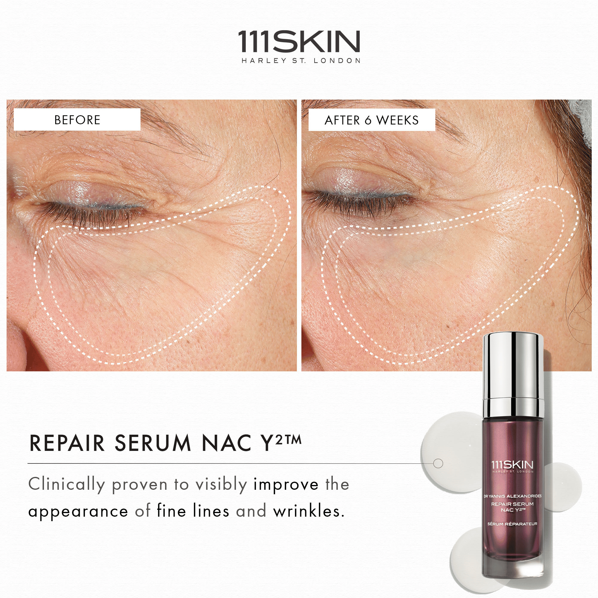 111SKIN Repair Serum NAC Y2 available at Exclusive Beauty Club. reduce fine lines and signs of aging