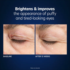 PCA Skin Hyaluronic Acid Microneedle Eye Patches Before and After Shop at Exclusive Beauty