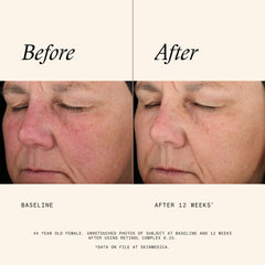 SkinMedica Age Defense Retinol Complex 0.25