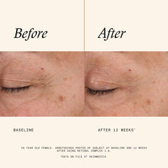 SkinMedica Age Defense Retinol Complex 1.0