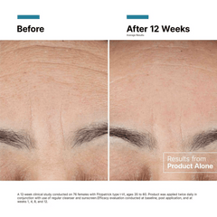 SkinCeuticals Advanced RGN-6