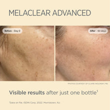 Load image into Gallery viewer, ISDIN Melaclear Advanced Dark Spot Correcting Serum
