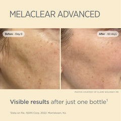 ISDIN Melaclear Advanced Dark Spot Correcting Serum