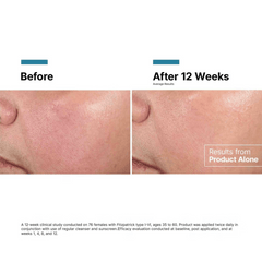 SkinCeuticals Advanced RGN-6