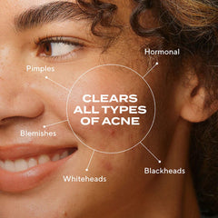 Murad Biome-Balancing Clear & Prevent Acne Treatment Serum