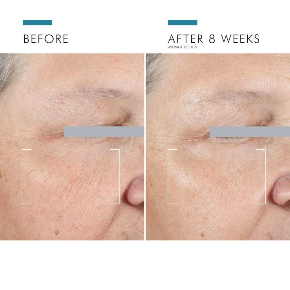 SkinCeuticals AGE Advanced Eye shop at Exclusive Beauty